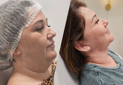 fotos antes e depois.jpeg
