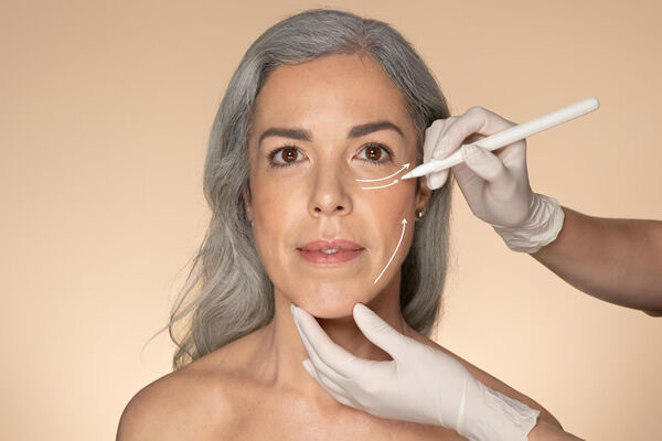 Fios de Sustentação A Solução Natural para um Rejuvenescimento Facial com a Dra. Rita de Cássia